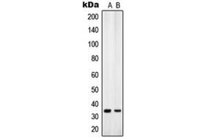 Western blot analysis of ANT4 expression in K562 (A), U251MG (B) whole cell lysates.