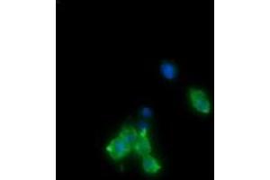 Image no. 2 for anti-Cancer/testis Antigen 1B (CTAG1B) antibody (ABIN1499898) (CTAG1B Antikörper)