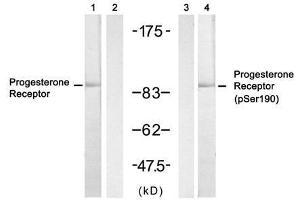 Western blot analysis of extract from SKOV3 cell untreated or treated with insulin, using Progesterone Receptor (Ab- 190) antibody (E021069, Lane 1 and 2) and Progesterone Receptor (phospho-Ser190) antibody (E011074, Lane 3 and 4). (Progesterone Receptor Antikörper  (pSer190))