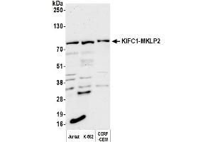Western Blotting (WB) image for anti-Kinesin Family Member C1 (KIFC1) (AA 1-50) antibody (ABIN7453560) (KIFC1 Antikörper  (AA 1-50))