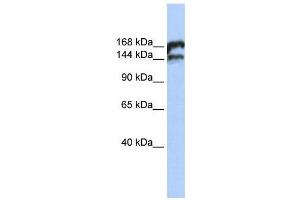 WB Suggested Anti-TOP2B  Antibody Titration: 0. (TOP2B Antikörper  (Middle Region))