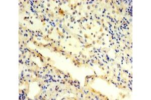 Immunohistochemistry (IHC) image for anti-Proteasome (Prosome, Macropain) 26S Subunit, ATPase, 3 (PSMC3) (AA 1-300), (Regulatory Subunit 6A) antibody (ABIN7142230)