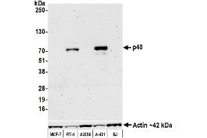 Western Blotting (WB) image for anti-p40 (p63 Delta) (AA 1-50) antibody (ABIN7449374) (p40 (p63 Delta) (AA 1-50) Antikörper)
