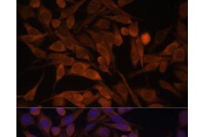 Immunofluorescence analysis of HeLa cells using CACYBP Polyclonal Antibody at dilution of 1:100. (CACYBP Antikörper)