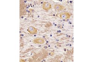 (ABIN388782 and ABIN2839114) staining TAU in Cynomolgus Monkey brain tissue sections by Immunohistochemistry (IHC-P - paraformaldehyde-fixed, paraffin-embedded sections). (tau Antikörper  (C-Term))