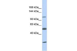 WB Suggested Anti-SLC39A10 Antibody Titration:  0. (SLC39A10 Antikörper  (N-Term))