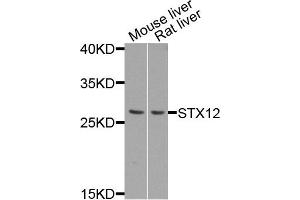 Western blot analysis of extract of mouse liver and rat liver cells, using STX12 antibody. (Syntaxin 12 Antikörper)