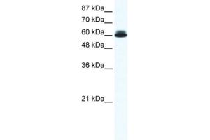 Western Blotting (WB) image for anti-DEAD (Asp-Glu-Ala-Asp) Box Polypeptide 27 (DDX27) antibody (ABIN2461352)