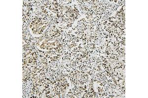 IHC analysis of NRF1 using anti-NRF1 antibody (ABIN7600874). (NRF1 Antikörper  (AA 246-503))
