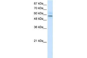 WB Suggested Anti-MGC4618 Antibody   Titration: 1. (TMEM175 Antikörper  (N-Term))
