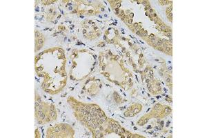 Immunohistochemistry of paraffin-embedded human kidney using N6AMT1 Antibody (ABIN5974334) at dilution of 1/100 (40x lens). (N6AMT1 Antikörper)