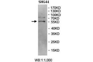 Western blot analysis of SHG44 cell Lysate using BRD9 Antibody. (BRD9 Antikörper  (AA 264-475))