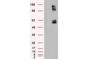 Image no. 6 for anti-Lipase, Endothelial (LIPG) antibody (ABIN1499176) (LIPG Antikörper)