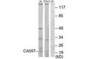 Western blot analysis of extracts from Jurkat/COLO205 cells, using C1orf57 Antibody. (C1orf57 Antikörper  (AA 141-190))