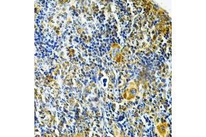 Immunohistochemistry of paraffin-embedded mouse spleen using GLRX Antibody (ABIN6127980, ABIN6141147, ABIN6141149 and ABIN6220940) at dilution of 1:200 (40x lens). (Glutaredoxin 1 Antikörper  (AA 1-106))
