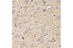 Immunohistochemistry of paraffin-embedded Rat brain using CNP antibody at dilution of 1:100 (x400 lens).