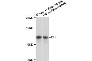 Western blot analysis of extracts of various cell lines, using DHH antibody (ABIN6292005) at 1:3000 dilution. (desert Hedgehog Antikörper)