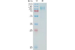 Human (13810-14451) Protein, His Tag on SDS-PAGE under reducing condition.