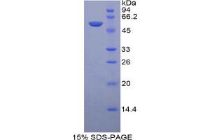 SDS-PAGE analysis of Human LAMP1 Protein. (LAMP1 Protein)
