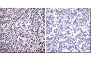 Immunohistochemistry analysis of paraffin-embedded human lymph node tissue, using B-RAF (Ab-601) Antibody. (SNRPE Antikörper  (AA 576-625))