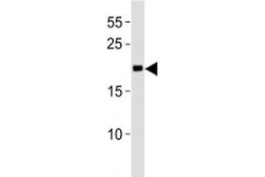 MGMT antibody western blot analysis in Jurkat lysate.