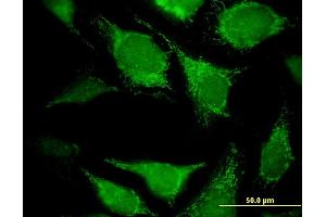 Immunofluorescence (IF) image for anti-2,4-Dienoyl CoA Reductase 2, Peroxisomal (DECR2) (AA 49-109) antibody (ABIN525576)