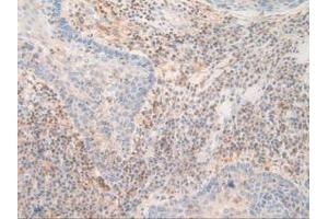 Figure. (PDXK Antikörper  (AA 29-253))