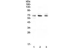 Western blot testing of human 1) A549, 2) SGC-7901 and 3) U-2 OS cell lysate with Bestrophin 1 antibody at 0. (Bestrophin 1 Antikörper)