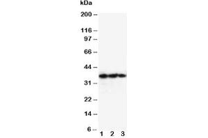 Western blot testing of EPO antibody and Lane 1:  Recombinant human protein 10ng;  2: 5ng;  3: 2. (EPO Antikörper  (AA 1-166))