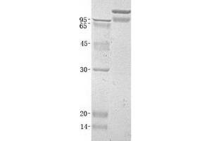 Validation with Western Blot (BAI3 Protein (His tag))