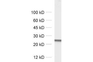 dilution: 1 : 1000, sample: rat brain homogenate (RAB5 Antikörper  (AA 182-196))