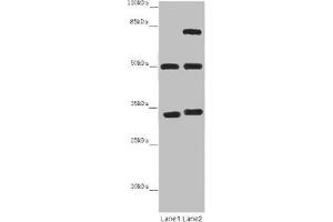Western blot All lanes: TUBA1B antibody at 12 μg/mL Lane 1: Mouse brain tissue Lane 2: Mouse liver tissue Secondary Goat polyclonal to rabbit IgG at 1/10000 dilution Predicted band size: 51, 38 kDa Observed band size: 51, 34, 75 kDa (TUBA1B Antikörper  (AA 29-310))
