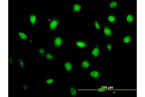 Immunofluorescence of monoclonal antibody to ZFYVE19 on HeLa cell. (ZFYVE19 Antikörper  (AA 1-396))