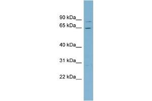 WB Suggested Anti-RPA1 Antibody Titration: 0. (RPA1 Antikörper  (Middle Region))