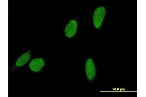 Immunofluorescence of purified MaxPab antibody to DCC1 on HeLa cell. (DSCC1 Antikörper  (AA 1-393))