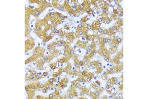 Immunohistochemistry of paraffin-embedded human liver using  antibody (ABIN6130862, ABIN6136444, ABIN6136445 and ABIN6216549) at dilution of 1:100 (40x lens). (Acox2 Antikörper  (AA 1-150))