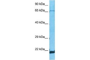 Host:  Rabbit  Target Name:  ZNF8  Sample Type:  A549 Whole Cell lysates  Antibody Dilution:  1. (ZNF8 Antikörper  (C-Term))
