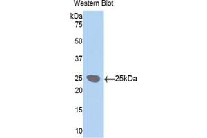 Western blot analysis of the recombinant protein. (LOXL1 Antikörper  (AA 369-574))