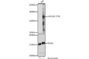 Western blot analysis of extracts of Raji cells, using Phospho-PLC gamma 2 (PLCG2)-Y759 pAb (ABIN7269341) at 1:2000 dilution or PLC gamma 2 (PLCG2) antibody (ABIN3023144, ABIN3023145, ABIN3023146 and ABIN6219411). (Phospholipase C gamma 2 Antikörper  (pTyr759))