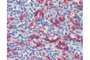 Human spleen; Anti-ZNF71 antibody IHC staining of human spleen. (ZNF71 Antikörper)