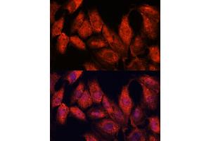 Immunofluorescence analysis of C6 cells using  antibody (ABIN7265407) at dilution of 1:100.