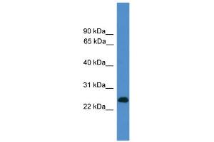 WB Suggested Anti-CD27 Antibody Titration: 0. (CD27 Antikörper  (C-Term))