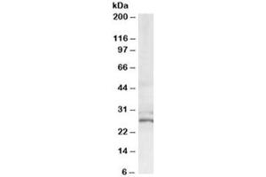 Western blot testing of HeLa lysate with TIP30 antibody at 0. (HIV-1 Tat Interactive Protein 2, 30kDa (HTATIP2) Antikörper)