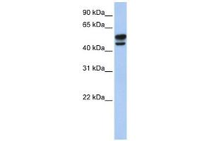 Vimentin antibody used at 1 ug/ml to detect target protein. (Vimentin Antikörper  (N-Term))