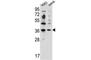 Western blot analysis of PPP1R3G Antibody (C-term) Cat. (PPP1R3G Antikörper  (C-Term))