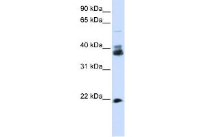 WB Suggested Anti-SYP Antibody Titration:  0. (Synaptophysin Antikörper  (N-Term))