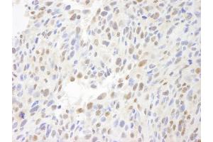Immunohistochemistry (IHC) image for anti-Chemokine (C-C Motif) Ligand 2 (CCL2) (AA 25-100) antibody (ABIN7448645)