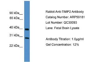 WB Suggested Anti-TIMP2  Antibody Titration: 0. (TIMP2 Antikörper  (Middle Region))