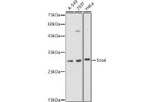 Western blot analysis of extracts of various cell lines, using Snail antibody (ABIN1682836, ABIN3019402, ABIN3019403, ABIN3019404 and ABIN6220883) at 1:1000 dilution.