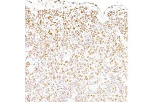 Immunohistochemistry (IHC) image for anti-Fused in Sarcoma (FUS) (AA 400-450) antibody (ABIN7453433) (FUS Antikörper  (AA 400-450))